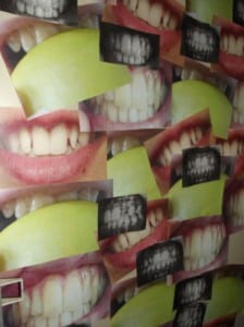 Apples and Teeth